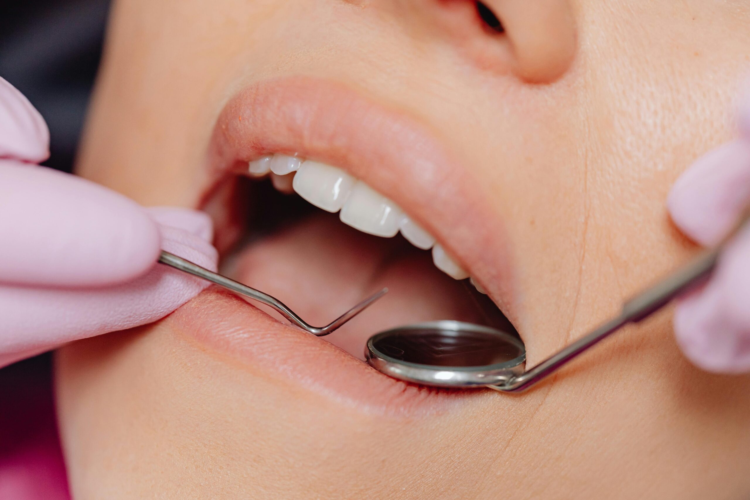 Close-up of a dental examination using dental tools for hygiene and care.